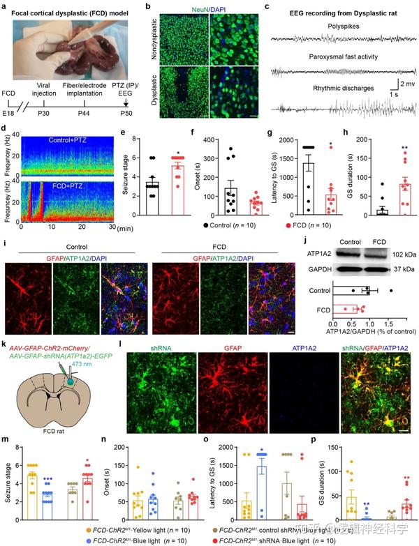 Nat Commun︱陈忠/汪仪团队揭示星形胶质细胞参与癫痫发作的新机制 - 知乎