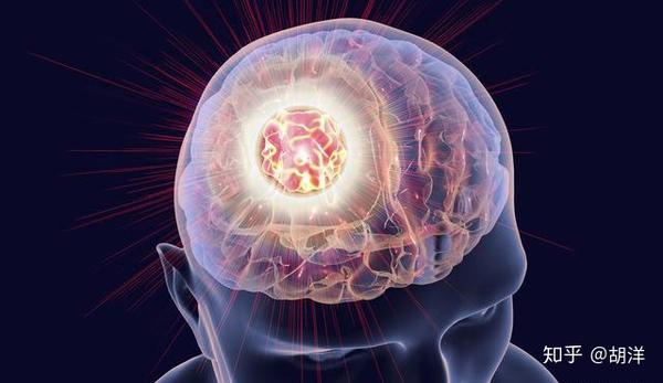肺部结节怀疑肺癌 手术前为什么要查脑 有人没查后悔了 脑转移 知乎 肺部结节怀疑肺癌 手术前为什么要查脑 有人没查后悔了 脑转移 知乎