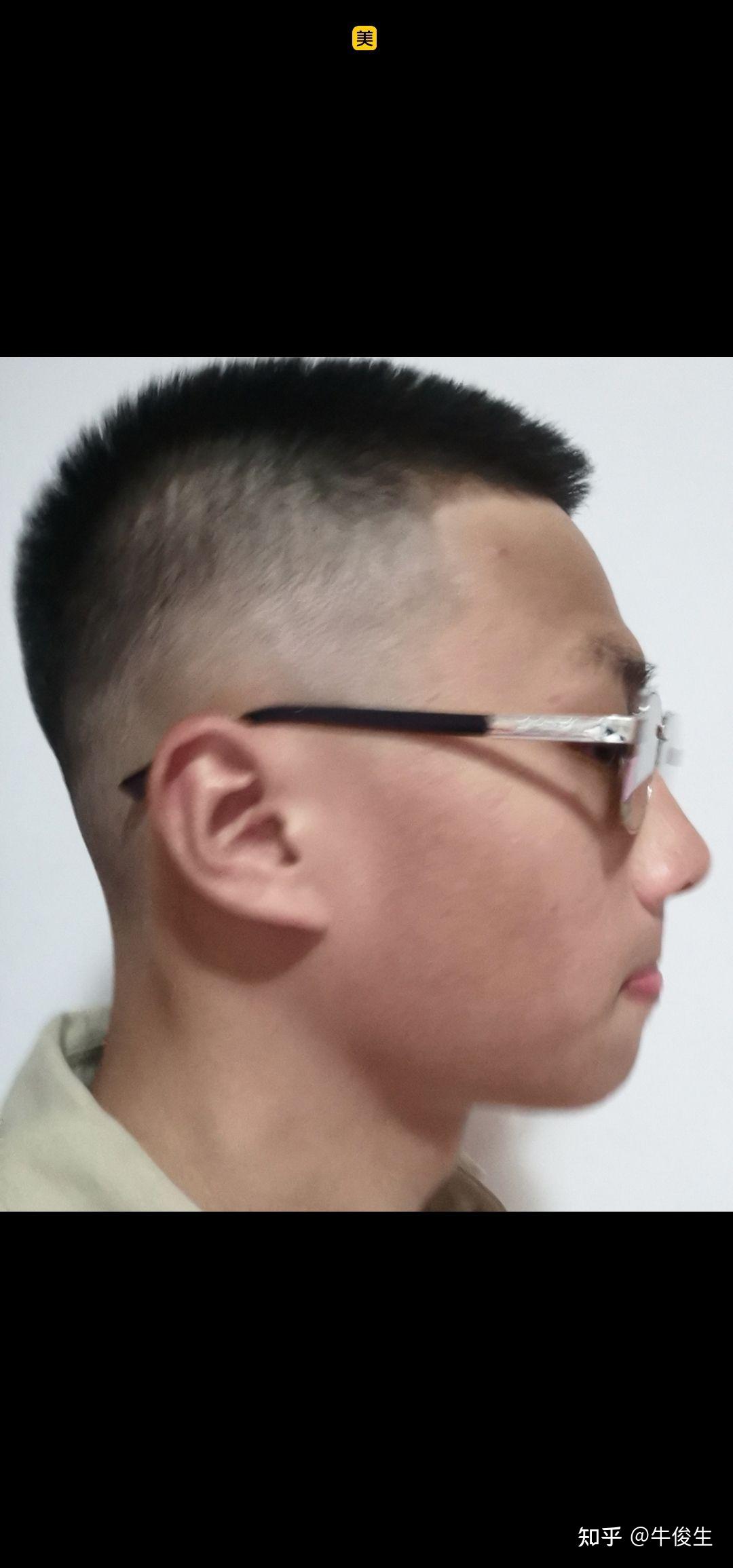 圆头扁头怎么区分