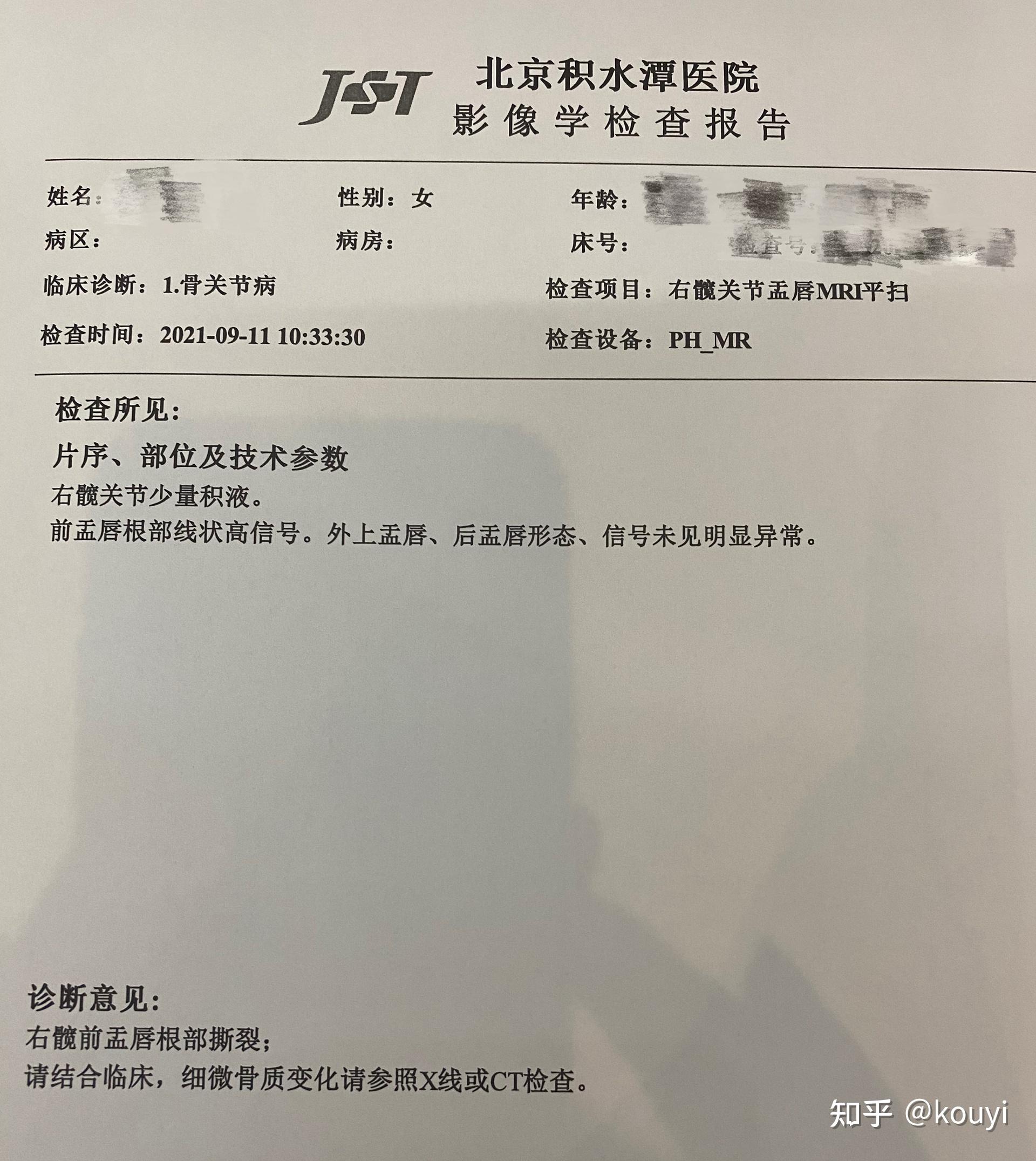 积水潭医院核磁加急找黄牛