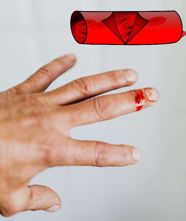 2020年最后的假期也结束了听说这个地方你还没来过欢迎参加血小板止血