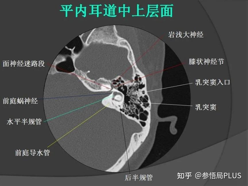 (CT基础)CT值,窗宽窗位,灰度值 - 知乎