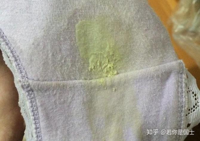 女的下面有3个信号,请警惕宫颈癌变,尤其hpv阳性感染者 - 知乎