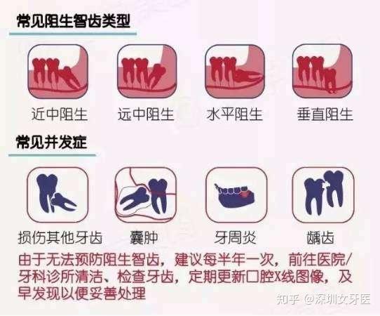 深圳牙医科普智齿蛀牙是要补牙还是拔牙