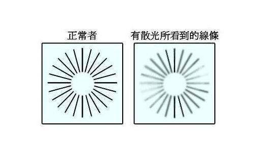 散光什么成语_散光是什么症状(2)
