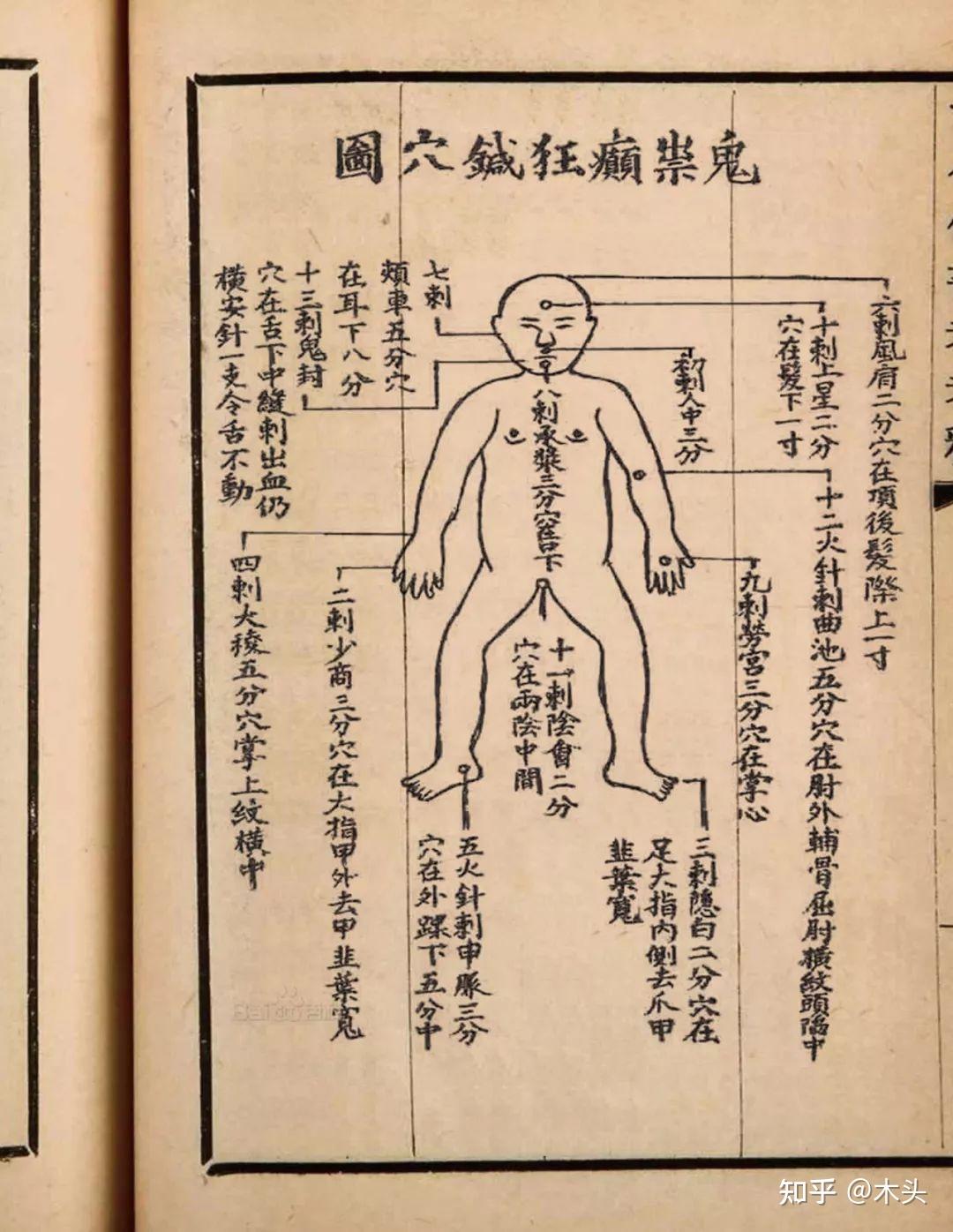 绝了传说中的驱鬼还阳的十三鬼针你知道吗去华手学中医理疗怎么样华手