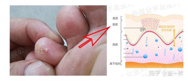 v2-6181faba1c27a5c8512a54ae9983ea75_r.jpg