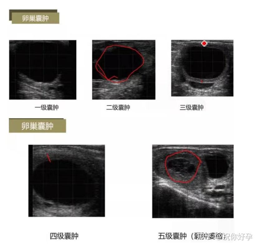 奶牛卵巢卵泡的部位图图片