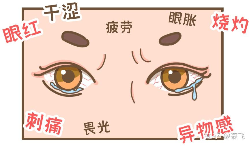 一定要了解!疫情期间得了眼病怎么办? - 知乎