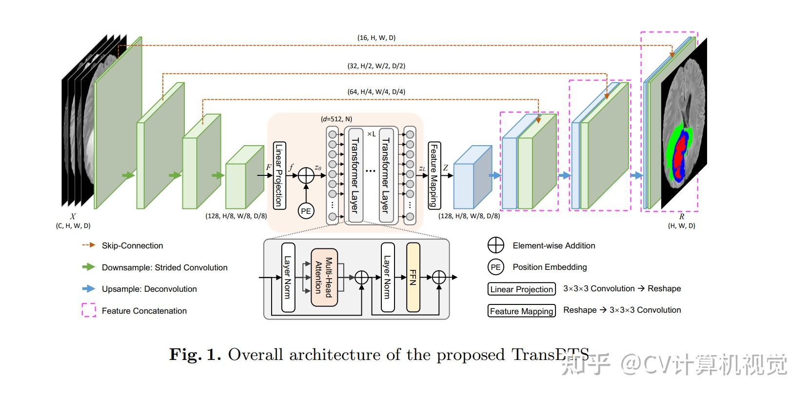 基于Transformer的医学图像分割15篇论文及开源代码 - 知乎