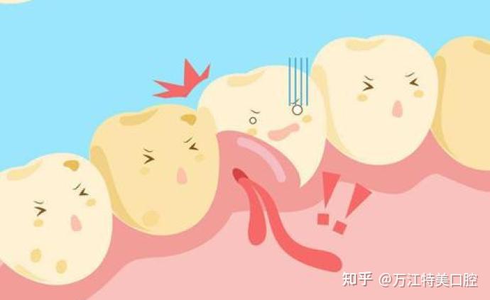尝过智齿的疼，却不知道什么是智齿冠周炎？ - 知乎