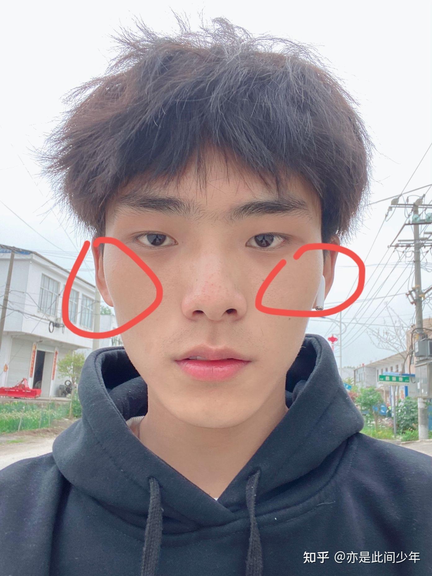 颧骨高很丑吗