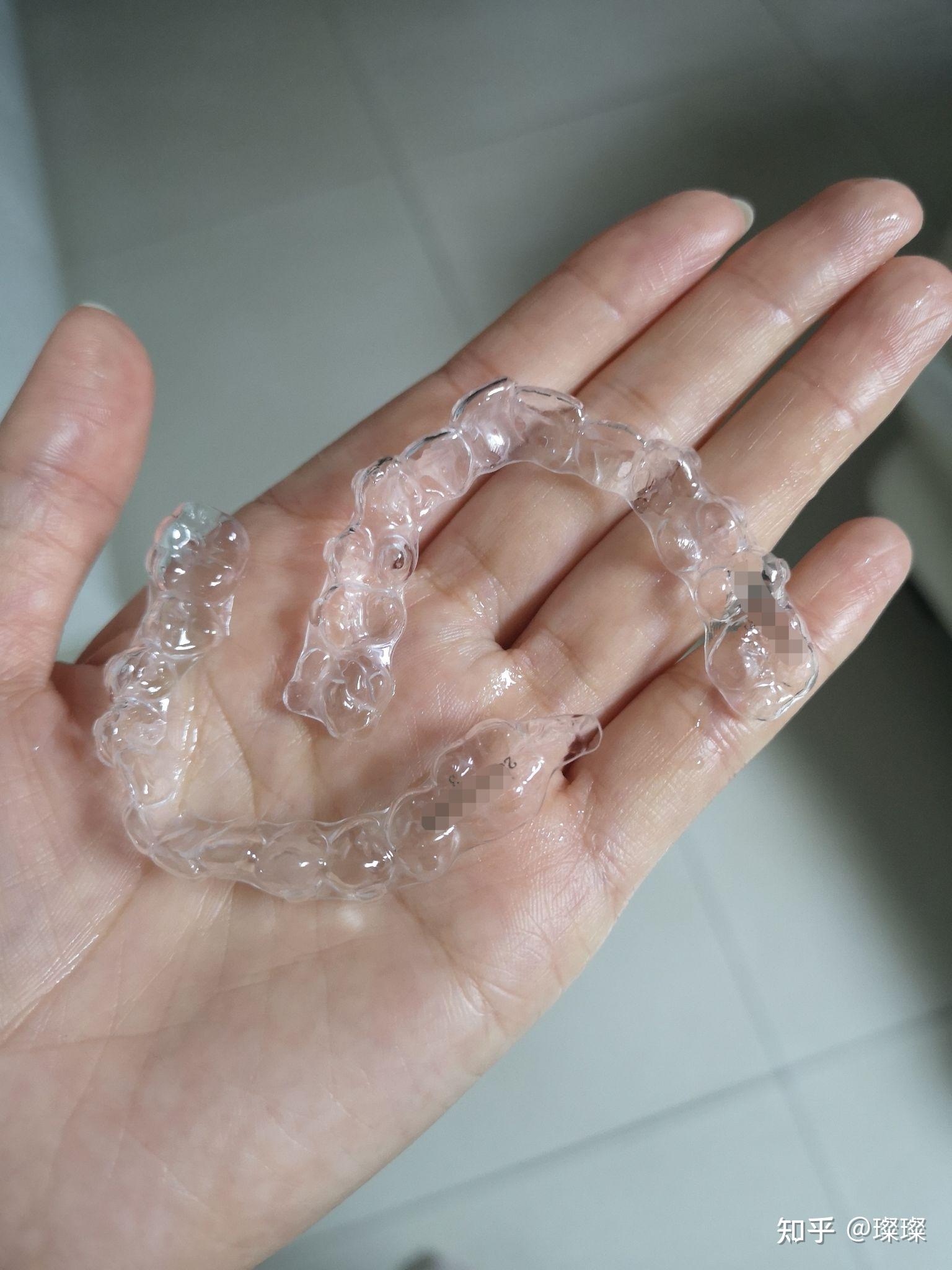 正雅隐形矫正日记