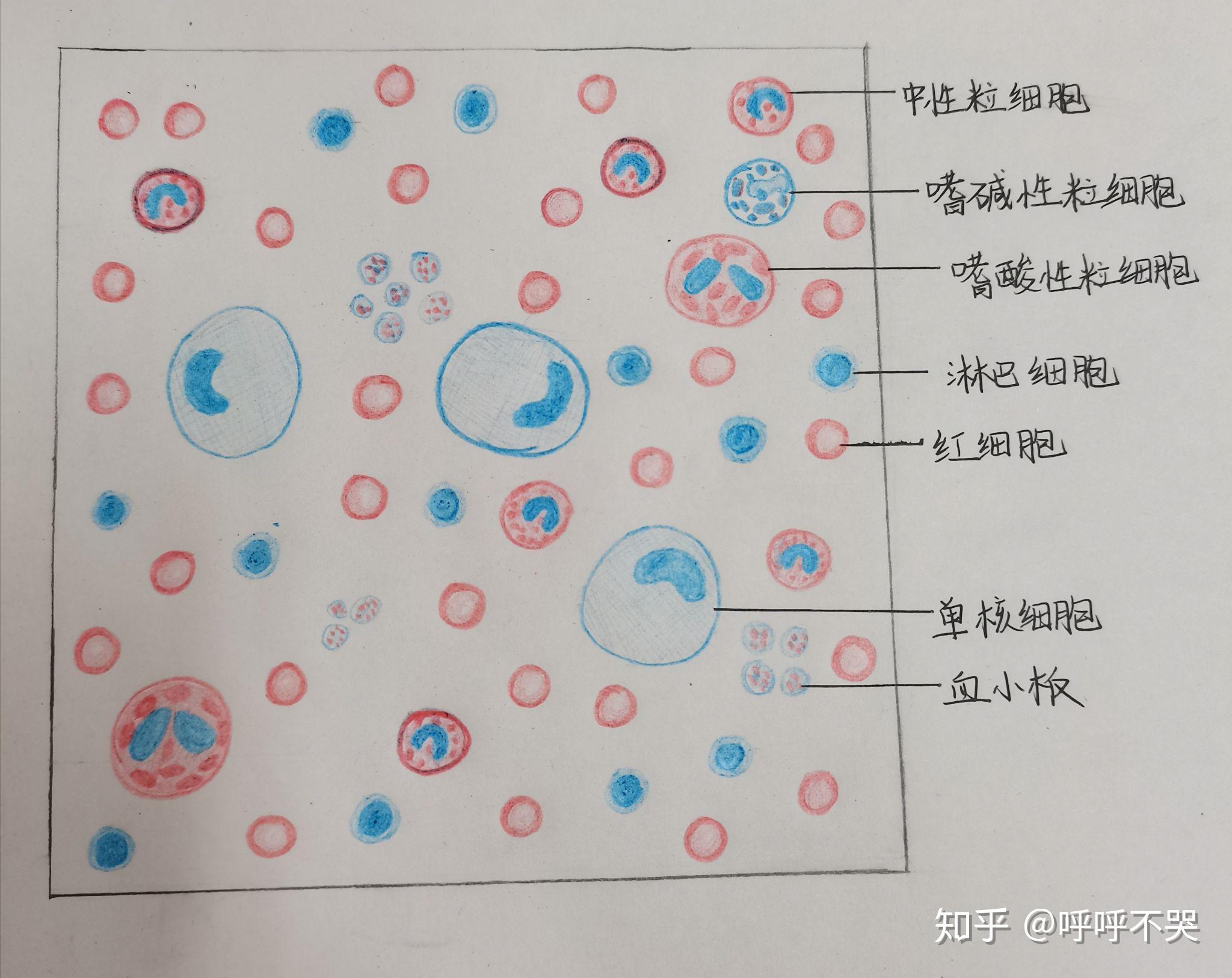 异型淋巴细胞手绘图图片