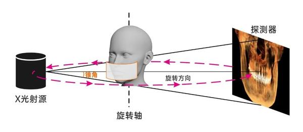大视野不可承受之“轻”——令人头疼的锥束伪影 - 知乎