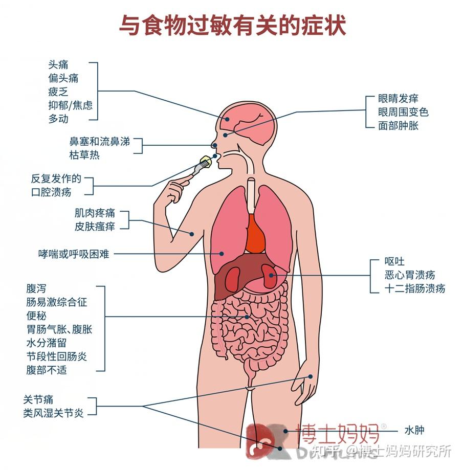 宝宝食物过敏不仅是皮炎湿疹,还有这些情况,辅食添加要注意!
