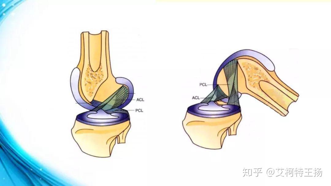 膝关节后交叉韧带pcl康复指南天津艾柯特运动康复