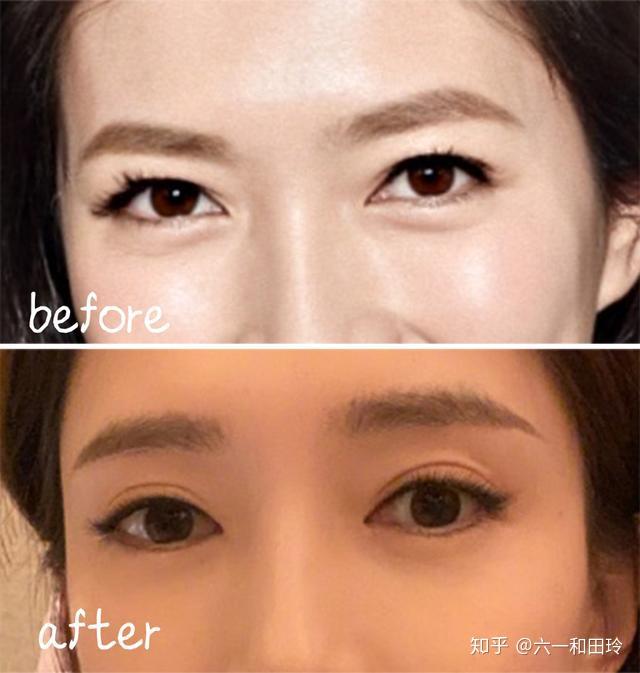江疏影的下垂眼改善之后,整个人年轻好多哇! - 知乎