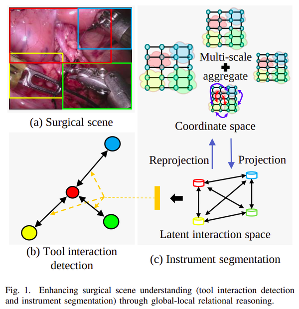【arXiv:2201】用于手术场景理解的全局推理多任务学习模型 - 知乎
