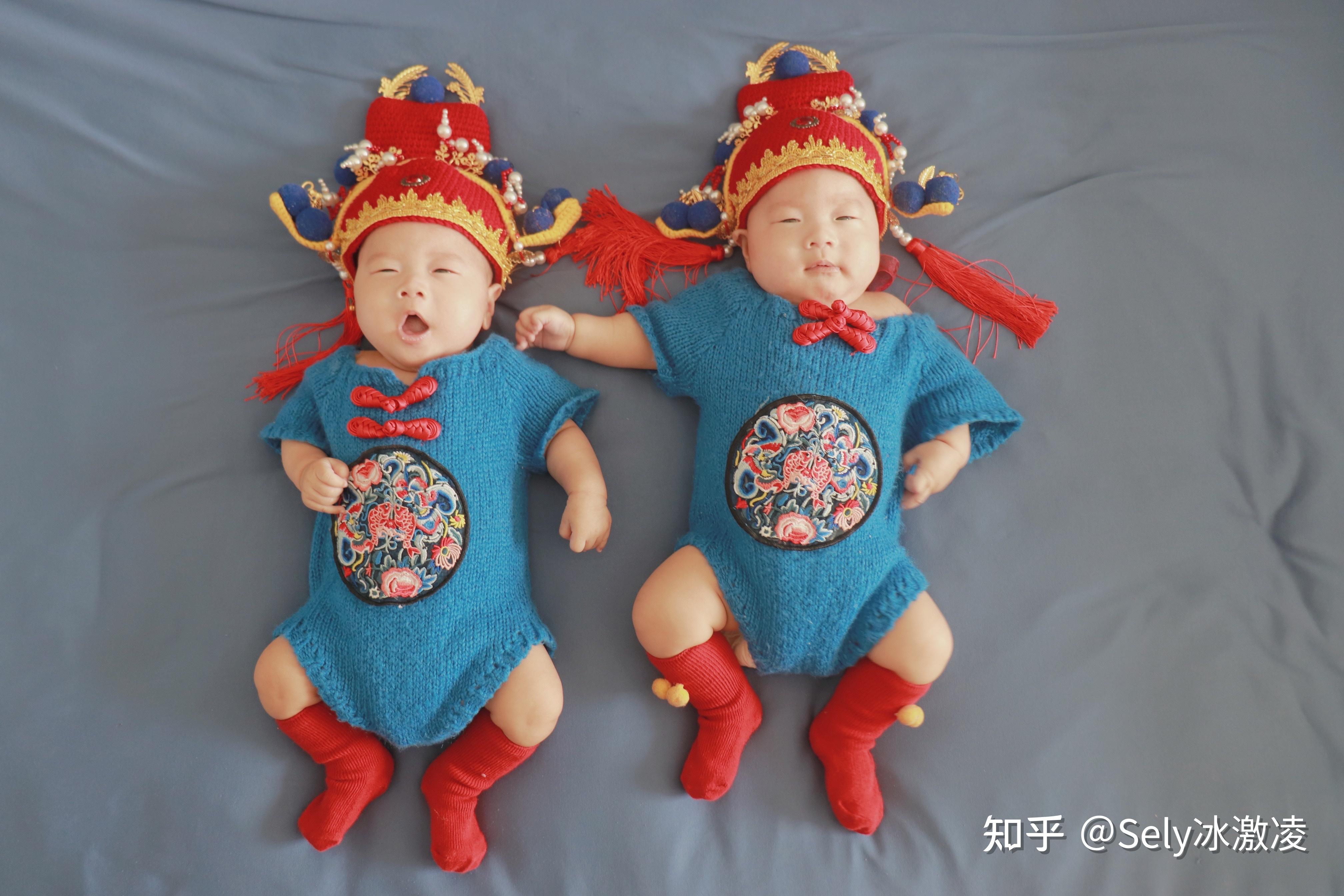 双胞胎的脐带拧成“麻花辫”，还打成了“中国结”：罕见的单绒单羊双胎在市二医院平安出生_媒体聚焦_石峰新闻网