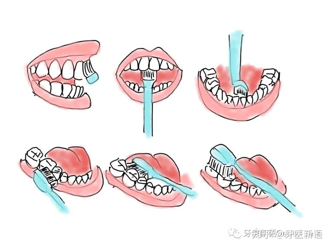 正确的刷牙方式|Illustration|Writing Exercises|刘玉美口腔插画_Original作品-站酷ZCOOL