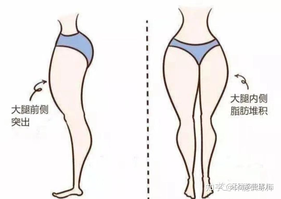 粗腿的5大原因和如何瘦大腿