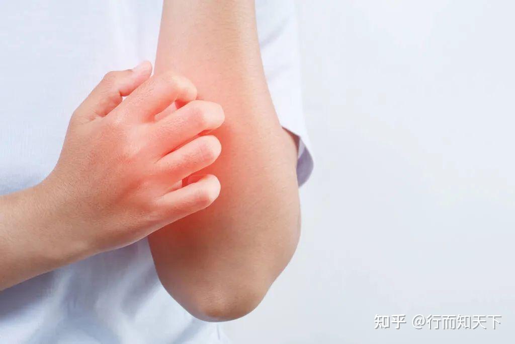 中医说的“排毒”,到底是在排什么?排哪里的毒? - 知乎