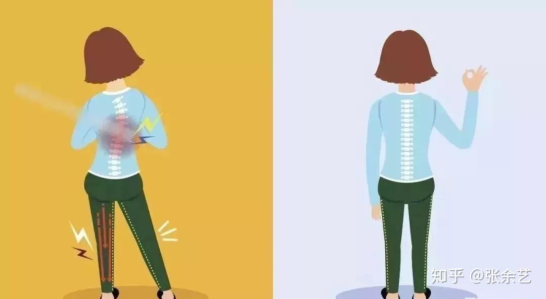 不良站姿及跑步姿势会加重某些肌肉的紧张度,时间久了,不仅使肌肉僵硬