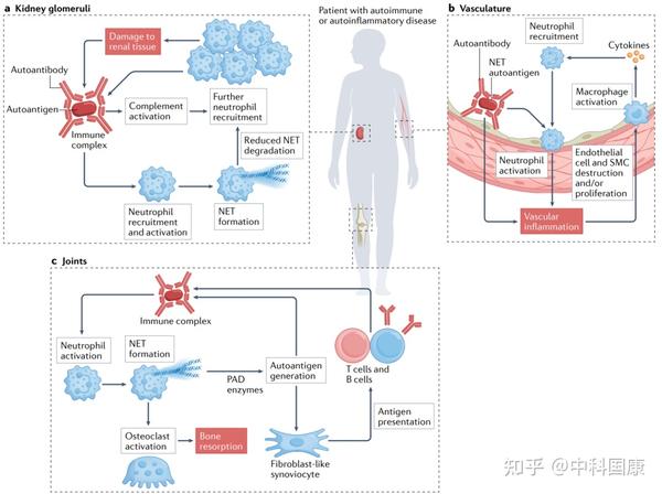 中性粒细胞研究——治疗自身免疫和炎性疾病的新钥匙！ - 知乎