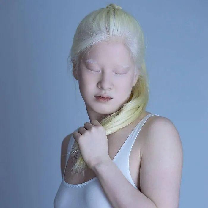 所以雪丽说自己是"幸运"的,她也希望这个世界能对"白化病人"更温柔