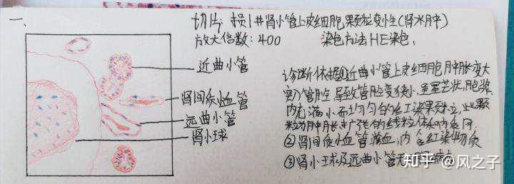 绘制肾近曲小管颗粒变性,皮下结缔组织玻璃样变性,肉芽组织的图片