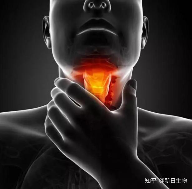 著名演员因“口交”患喉癌？7成喉癌与HPV有关，原因难以启齿 - 知乎