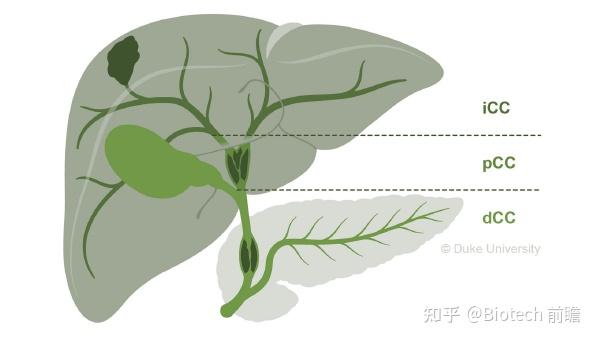 CA神刊丨肝内胆管癌治疗进展：临床医生当前和未来治疗前景概述 - 知乎