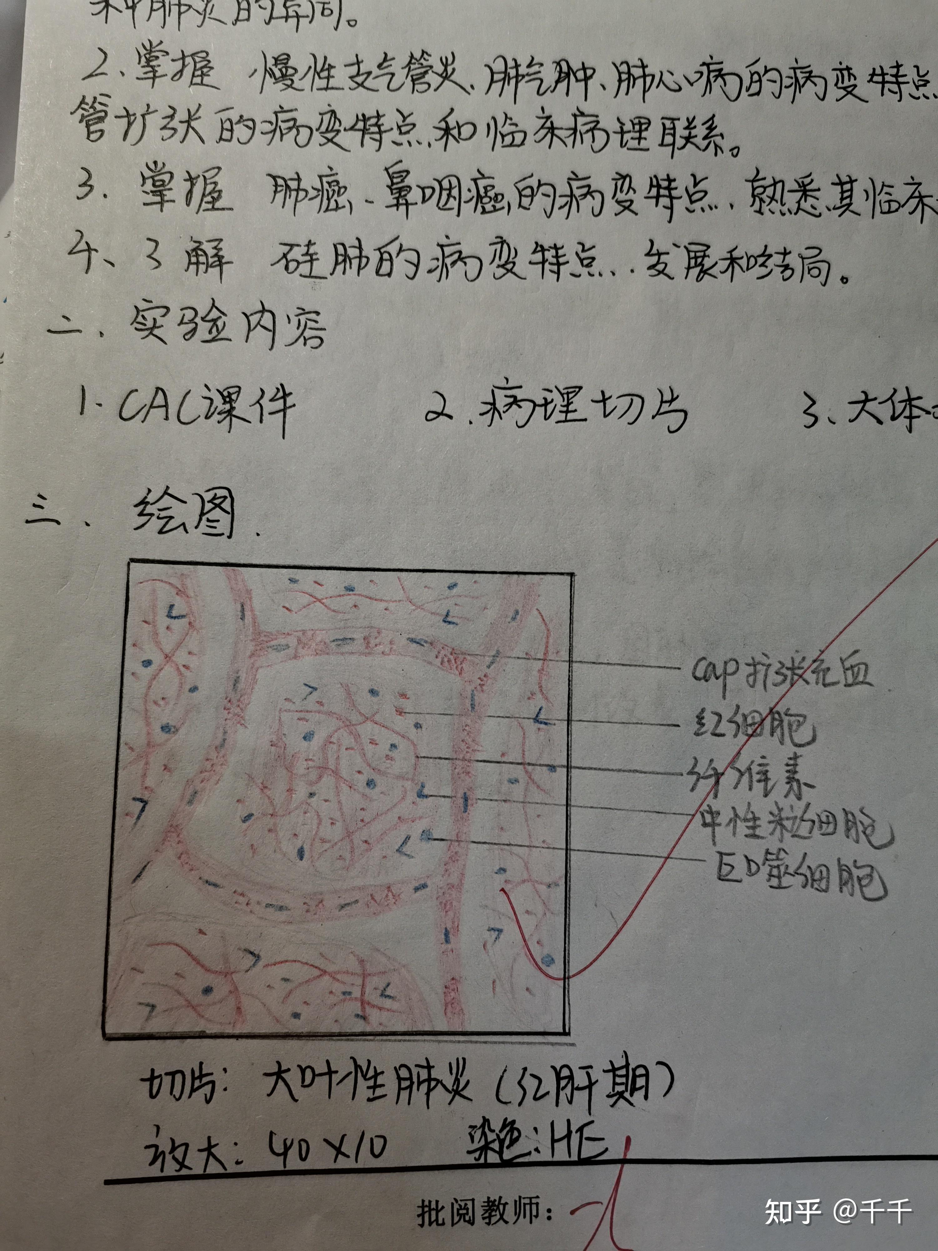 病理紅藍鉛筆繪圖