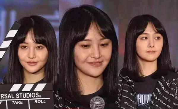 郑爽被爆整形 高清图照流出 令人心疼和惋惜 隆鼻失败怎样修复 知乎