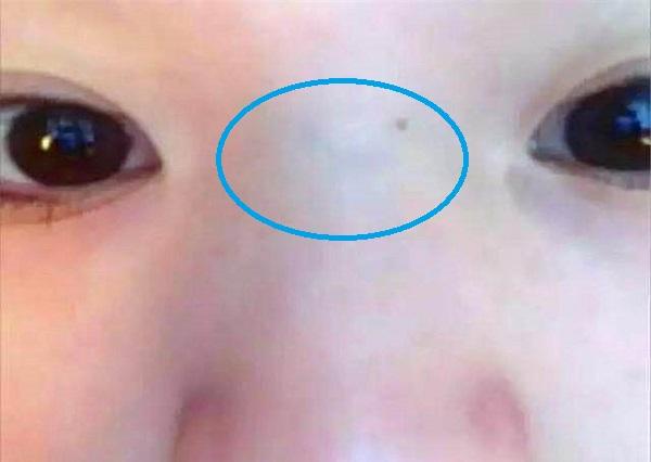 宝宝闹人不好带是因为鼻梁有青筋别乱信真正原因是这些