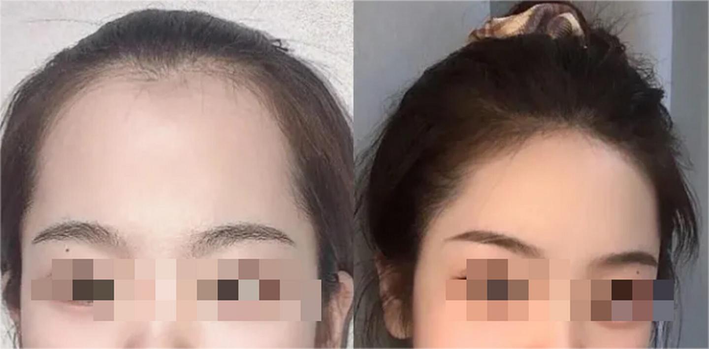 必看！极客侠分享假发、植发行业的避雷避坑指南 - 知乎
