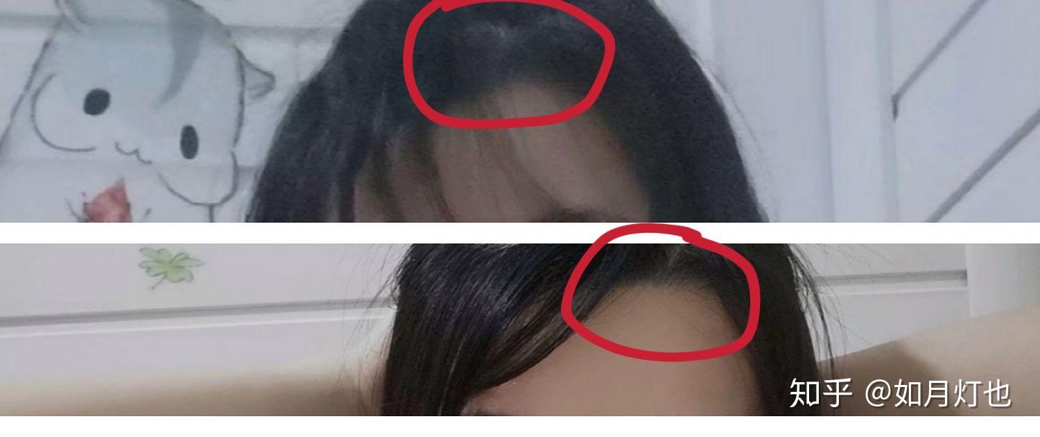 女生发际线处有个旋很难做发型有同胞么怎么破