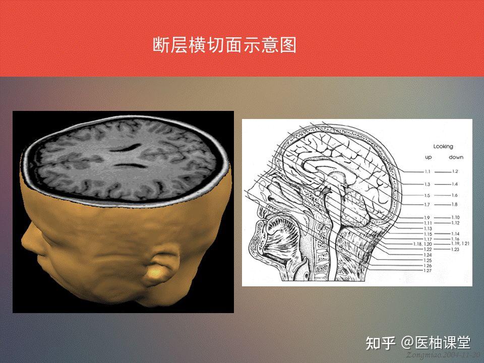 脑功能区及解剖学定位 - 知乎