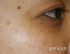v2-65440fb65b9405e8315e73ed8a5a890d_b.jpg