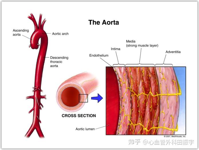 主动脉根部图解图片