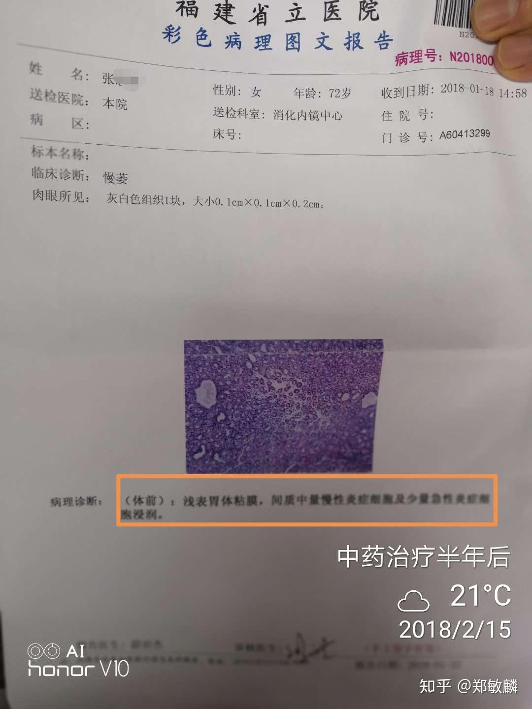 郑敏麟医案萎缩性胃炎伴肠化直肠多发息肉兼失眠案