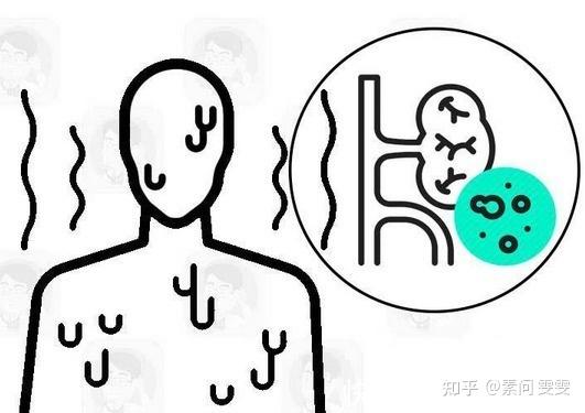 这是简化的一个过程,实际更复杂,还是小肠的 大肠膀胱等等一