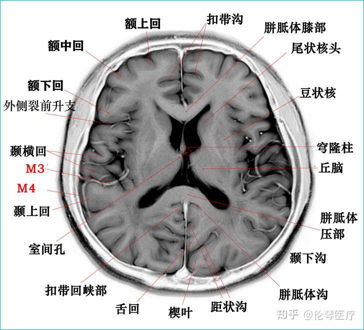 超赞！高清颅脑断层解剖图谱【磁共振+大体标本】 - 知乎