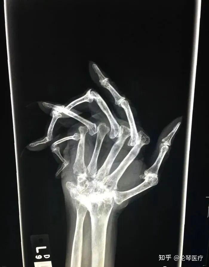 听说看到这些奇奇怪怪的x光片是影像医生的职业福利医生医事