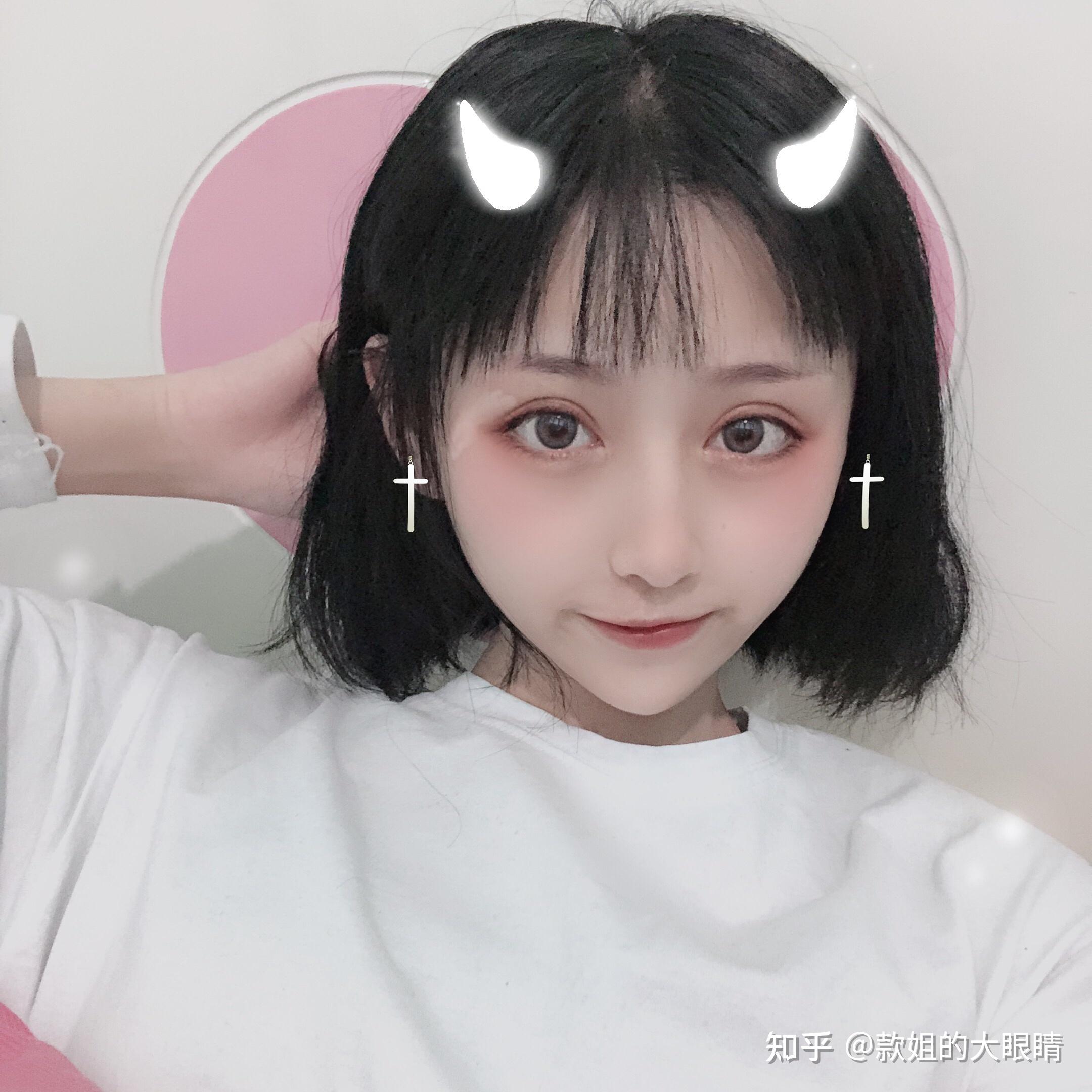 双眼皮各种类型案例,攻略分享