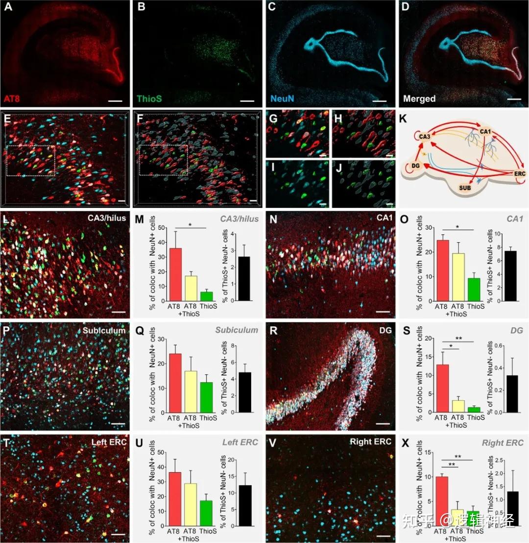 alzheimersdementia一种新的阿尔兹海默症非人类灵长类动物模型恒河猴