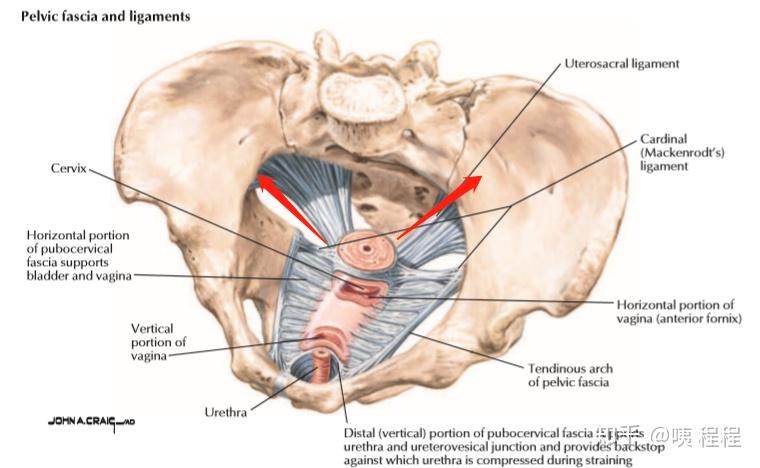 下图可以看出子宫骶韧带的起止部位:起于子宫颈后的上外侧,止于第2,3