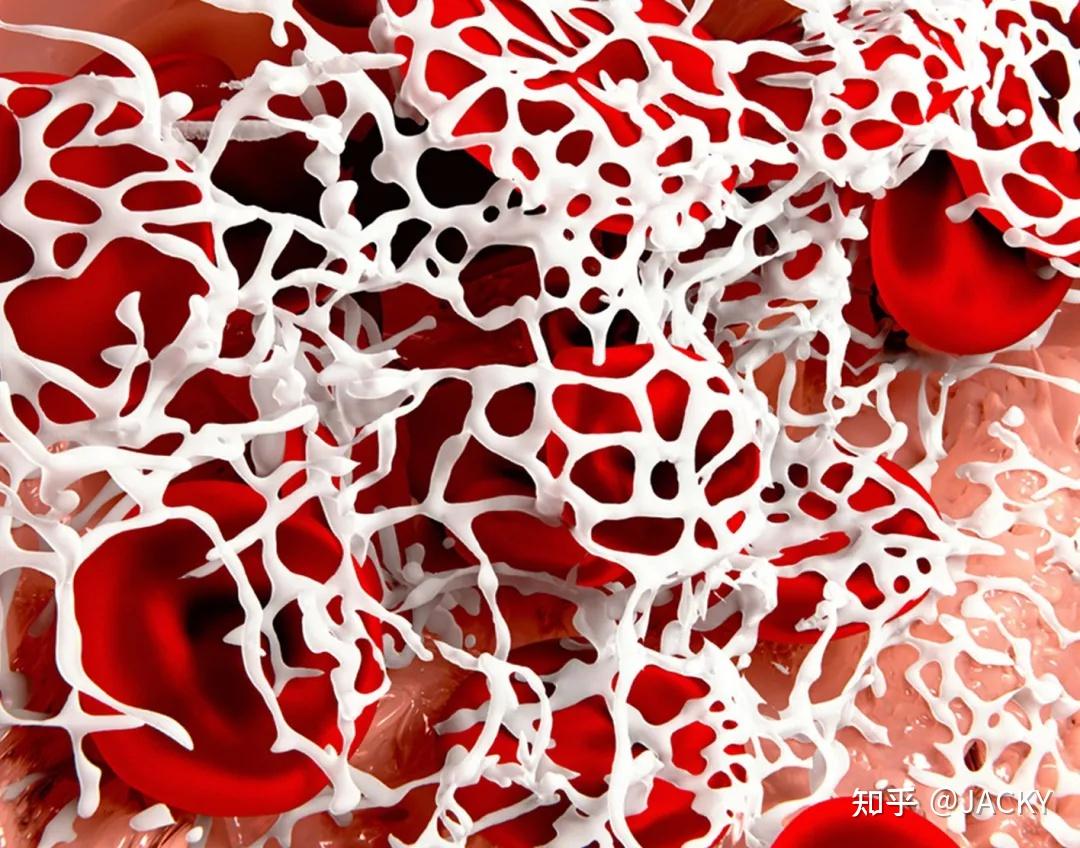 纤维蛋白原直接与神经细胞相互作用引起脑炎症