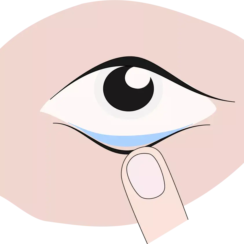 阿托品抗菌视疲劳带你重新认识眼药水